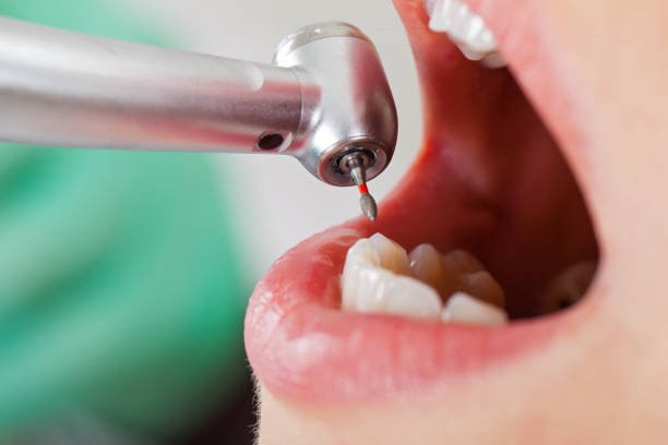 Best Emergency Dental Care for Trauma or Injury in Leawood, KS